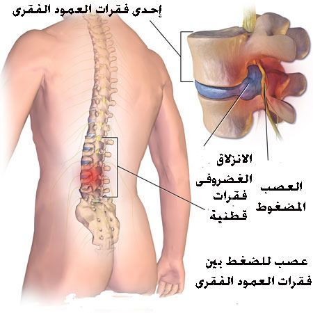 Diagnosis of Back and Spinal Pain
