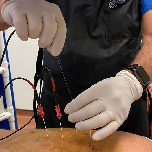 افضل دكتور علاج الألم في مصر