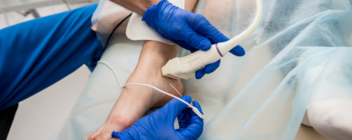 العلاج بالتردد الحراري