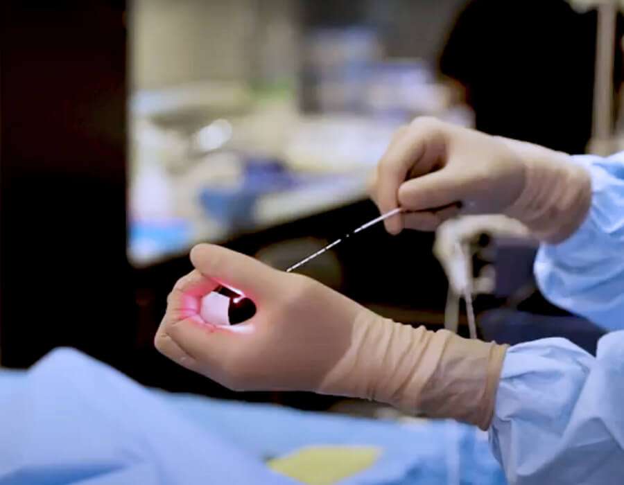 علاج الغضروف بالتردد الحراري