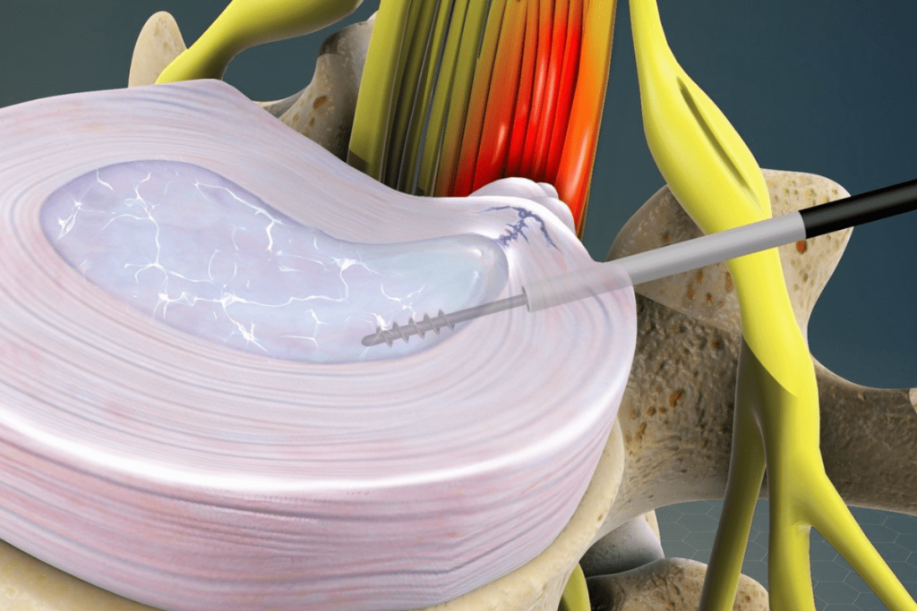 آلام العمود الفقري