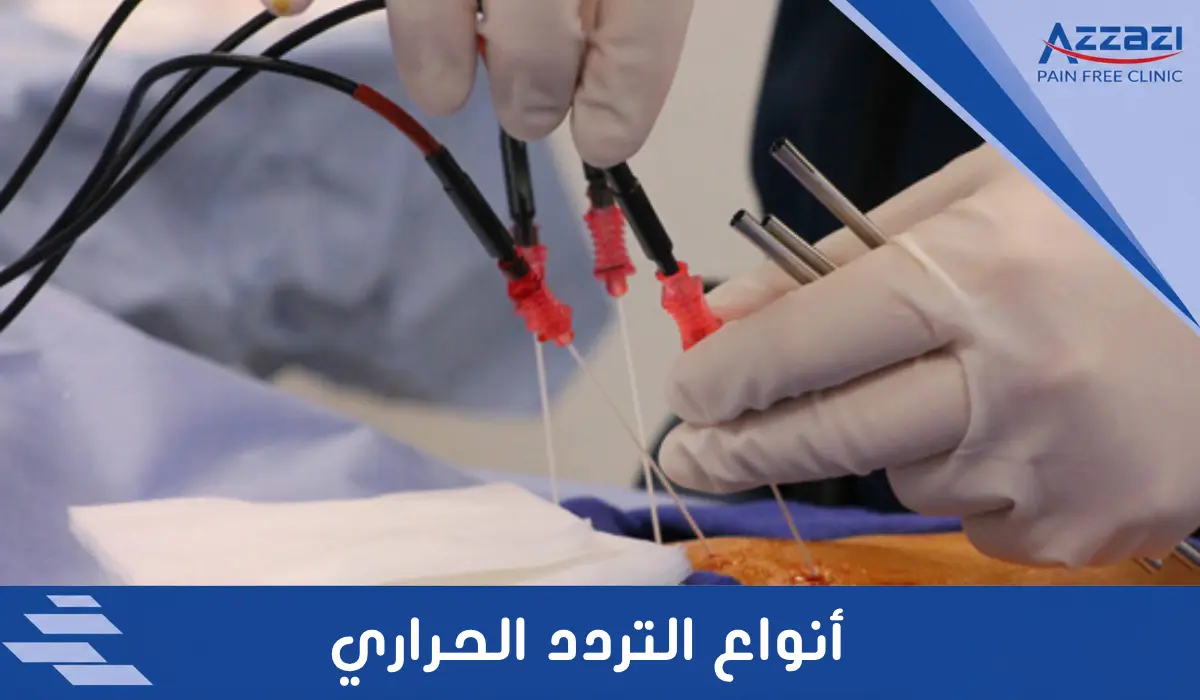 أنواع التردد الحراري