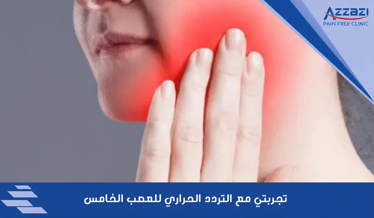 تجربتي مع التردد الحراري للعصب الخامس