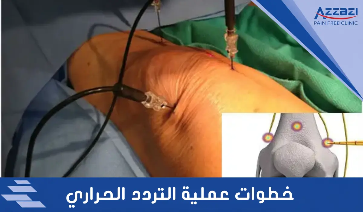 خطوات عملية التردد الحراري