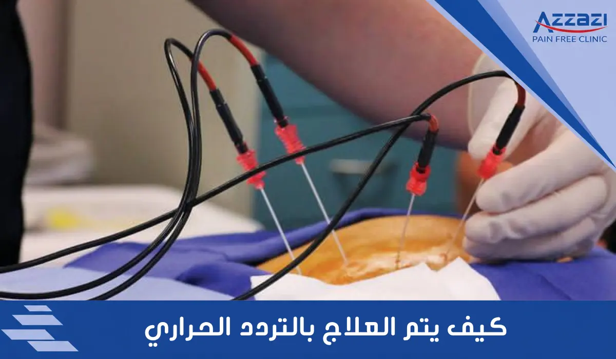 كيف يتم العلاج بالتردد الحراري